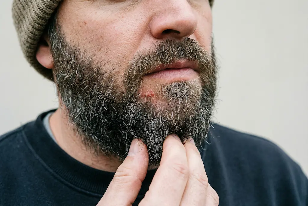 Gros plan barbe grisonnante, main grattant peau irritée